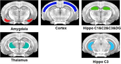 Oligomeric amyloid-β targeted contrast agent for MRI evaluation of Alzheimer’s disease mouse models